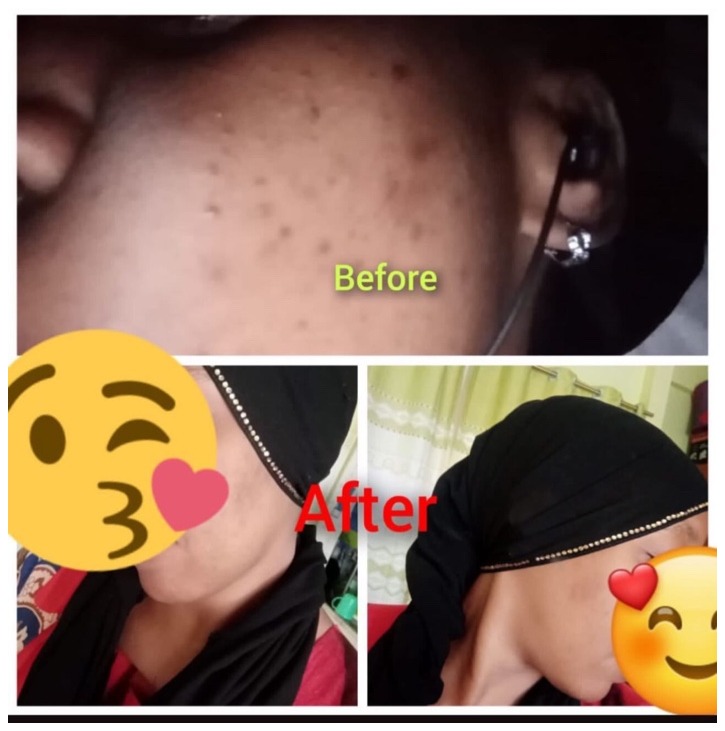 Kidoty Skin Care client review 18